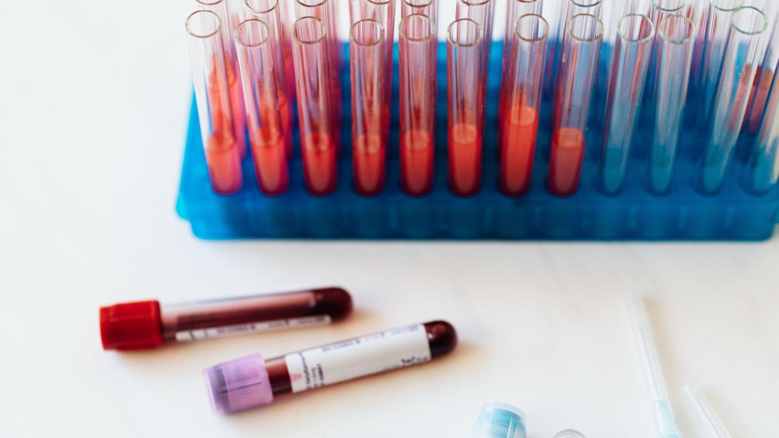 Dunn County Offering Lead Screening Tests for Children